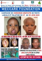 Campagne de Chirurgie Gratuite de Fente Labiale et Palatine
